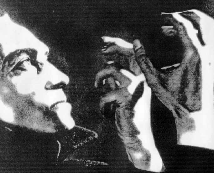 HANDS OF ORLAC: Conrad Veidt as Paul Orlac